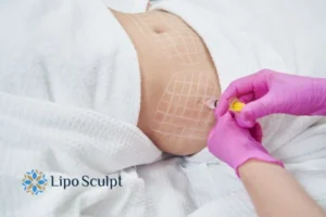 Are The Results From Aqualyx Permanent? 1 Do you want to know how long Aqualyx Southampton results last?