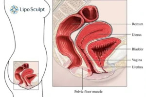 Treatment For A Leaky Bladder 2 How EM Chair treatment Southampton can help Leaky bladder issues. Read more now!