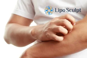 Best Actinic Keratoses Removal 4 prevent your actinic keratoses Southampton getting worse - call our team today!