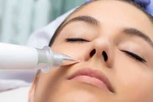 Best Actinic Keratoses Removal 3 Actinic keratoses Southampton solutions - book in today!