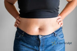 Bidding Farewell to Muffin Tops with Aqualyx Fat Injections 2 Do you wish you could reduce your muffin top Southampton With Aqualy fat dissolving injections you can!
