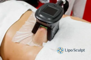 Does Fat Freezing At Home Work? 3 Fat freezing at home from Lipo Sculpt Southampton
